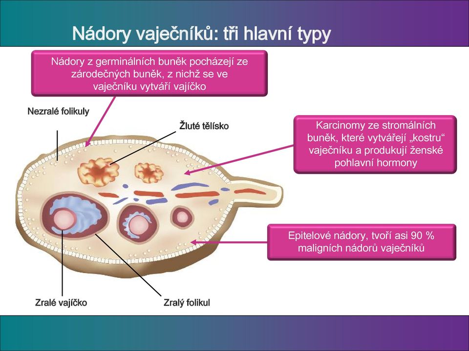 ze stromálních buněk, které vytvářejí kostru vaječníku a produkují ženské pohlavní