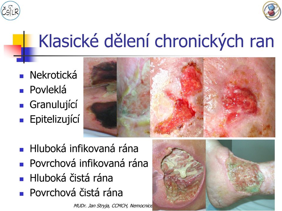 Epitelizující Hluboká infikovaná rána