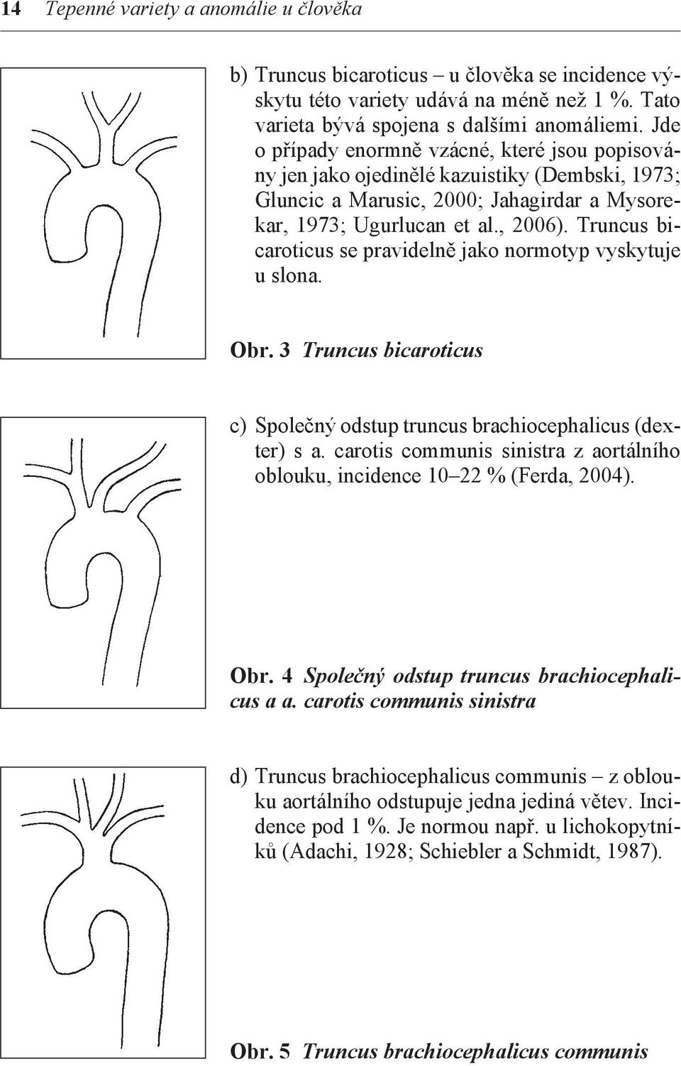 Truncus bicaroticus se pravidelně jako normotyp vyskytuje u slona. Obr. 3 Truncus bicaroticus c) Společný odstup truncus brachiocephalicus (dexter) s a.