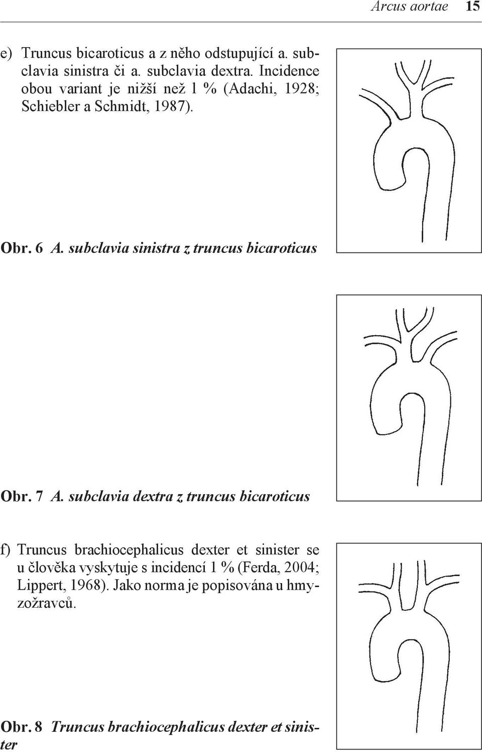 subclavia sinistra z truncus bicaroticus Obr. 7 A.