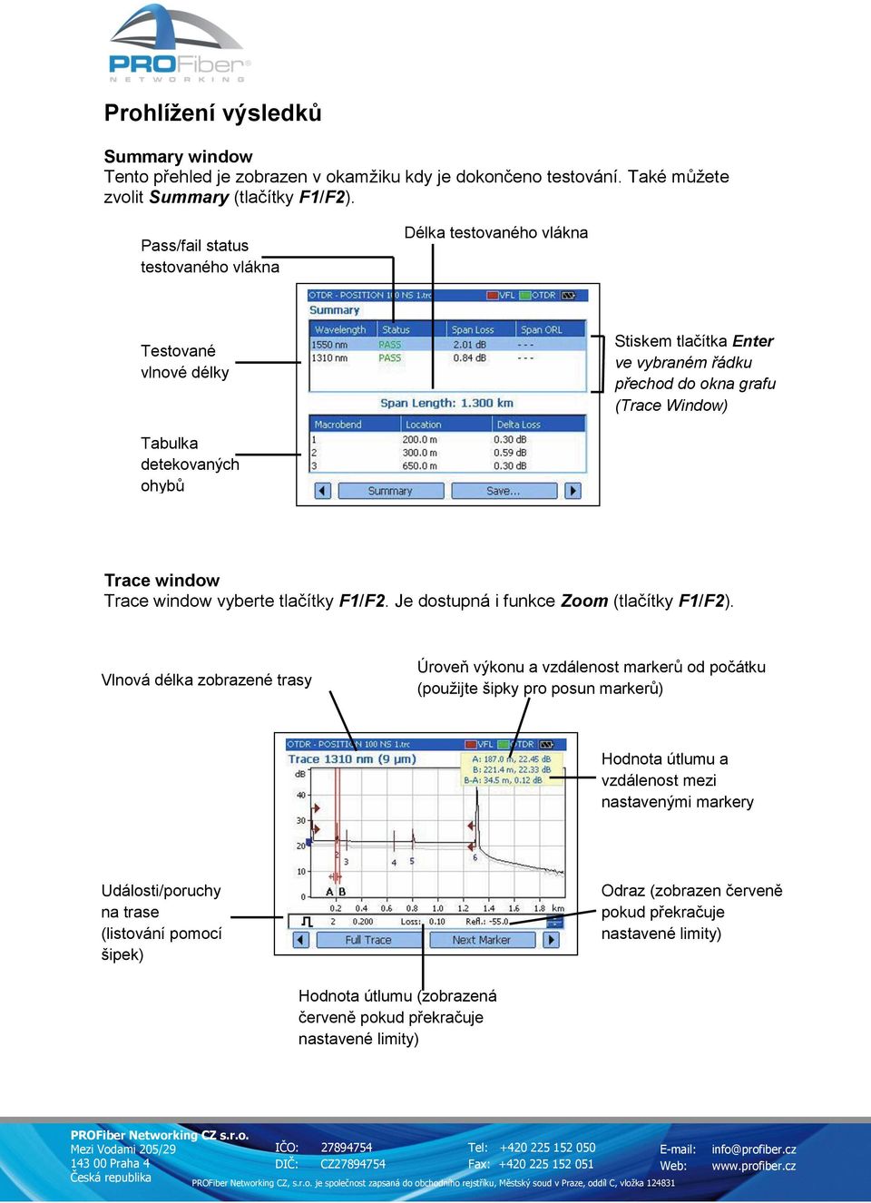 Trace window Trace window vyberte tlačítky F1/F2. Je dostupná i funkce Zoom (tlačítky F1/F2).