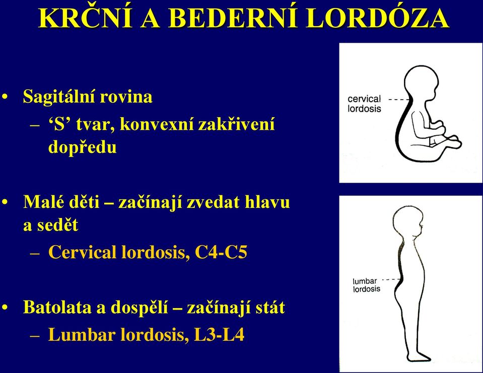 zvedat hlavu a sedět Cervical lordosis, C4-C5