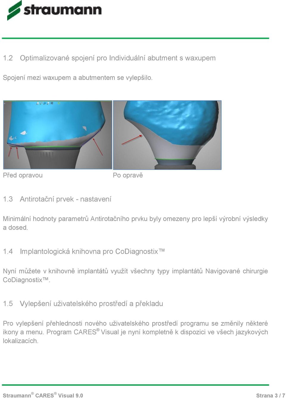 4 Implantologická knihovna pro CoDiagnostix Nyní můžete v knihovně implantátů využít všechny typy implantátů Navigované chirurgie CoDiagnostix. 1.