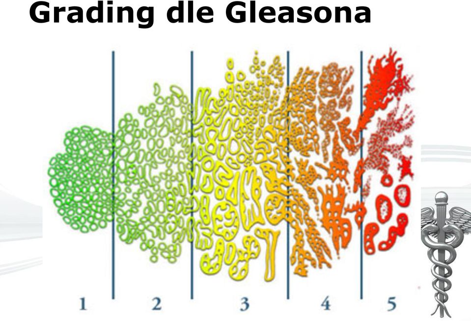 Gleasona