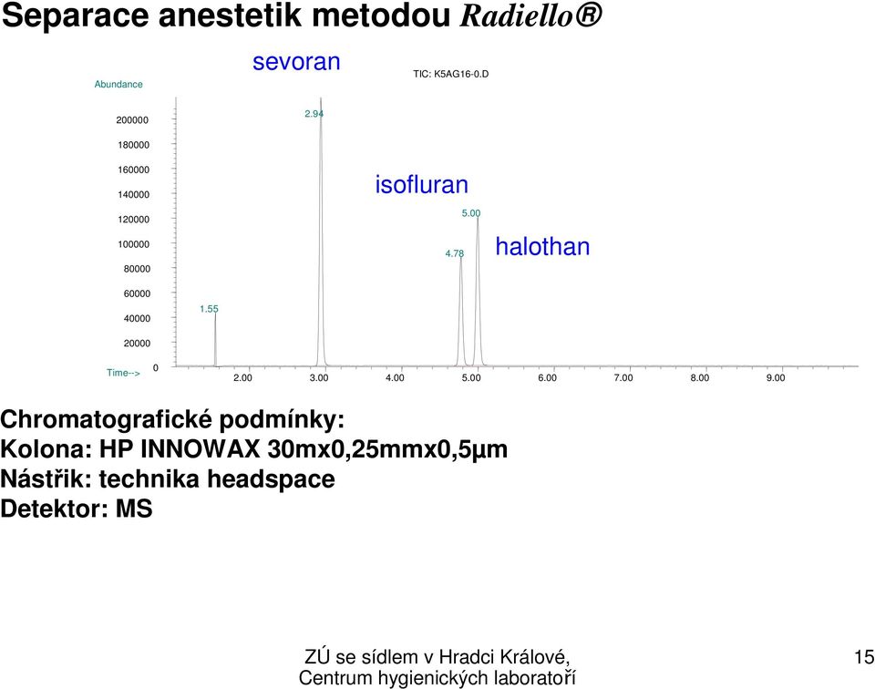 00 halothan 60000 40000 1.55 20000 Time--> 0 2.00 3.00 4.00 5.00 6.00 7.00 8.00 9.