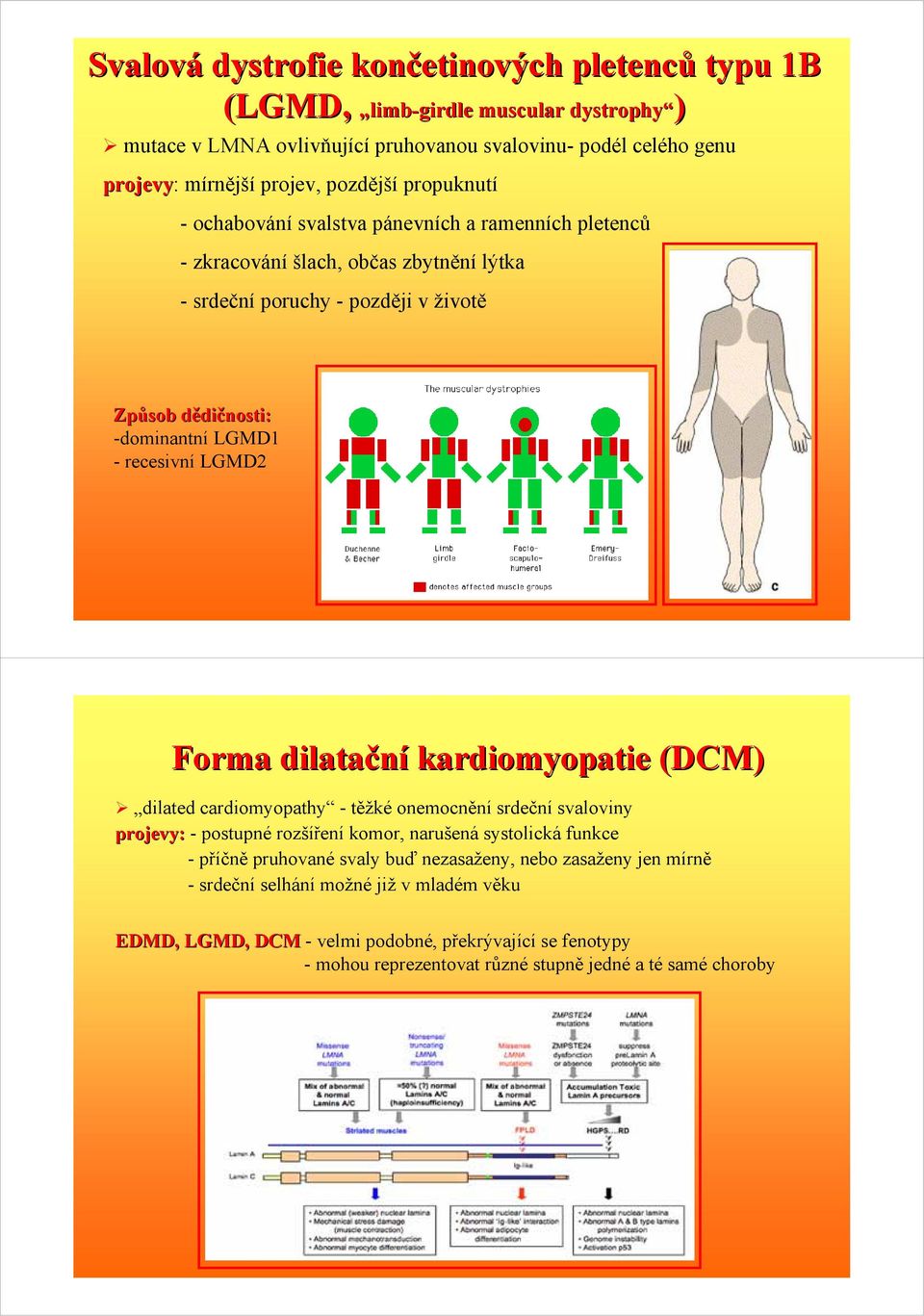 LGMD2 Forma dilatační kardiomyopatie (DCM) dilated cardiomyopathy - těžké onemocnění srdeční svaloviny projevy: - postupné rozšíření komor, narušená systolická funkce -příčně pruhované svaly buď