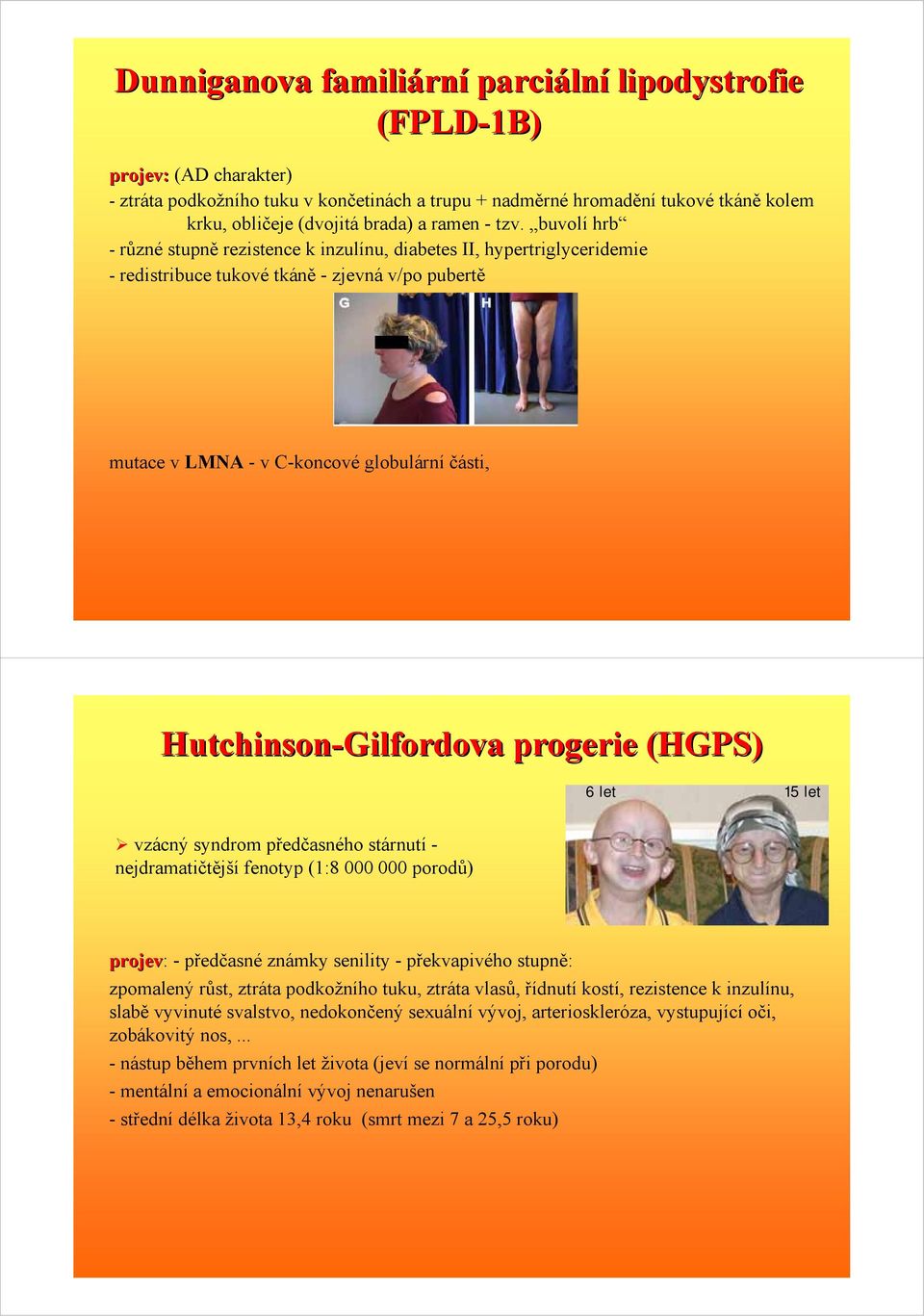buvolí hrb - různé stupně rezistence k inzulínu, diabetes II, hypertriglyceridemie - redistribuce tukové tkáně - zjevná v/po pubertě mutace v LMNA - v C-koncové globulární části,