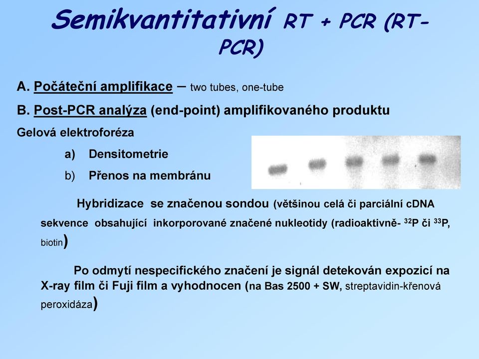 se značenou sondou (většinou celá či parciální cdna sekvence obsahující inkorporované značené nukleotidy (radioaktivně- 32 P