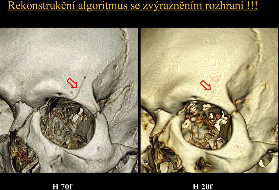 algoritmus se