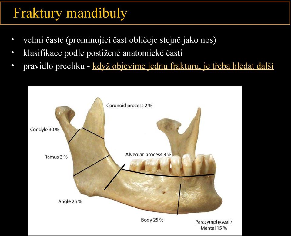 postižené anatomické části pravidlo preclíku - když