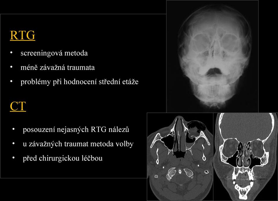 etáže CT posouzení nejasných RTG nálezů u