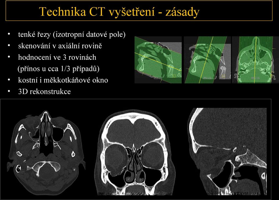 rovině hodnocení ve 3 rovinách (přínos u cca