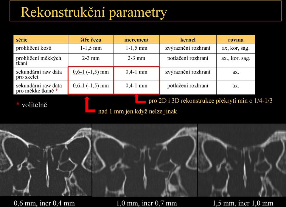 sekundární raw data pro skelet 0,6-1 (-1,5) mm 0,4-1 mm zvýraznění rozhraní ax.