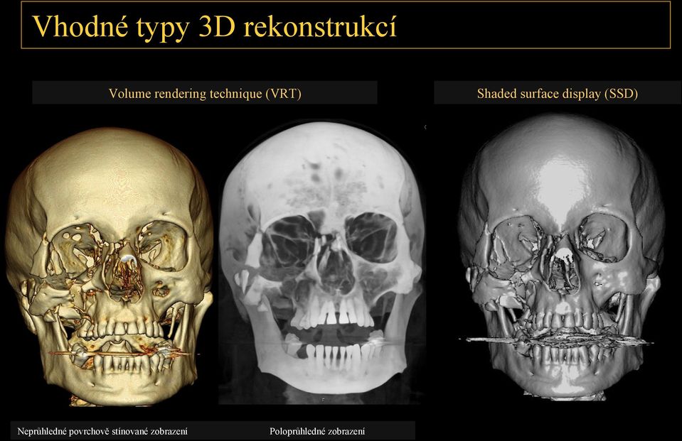 Neprůhledné povrchově stínované zobrazení