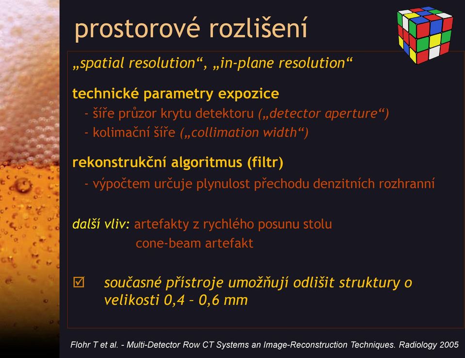 přechodu denzitních rozhranní další vliv: artefakty z rychlého posunu stolu cone-beam artefakt současné přístroje umožňují