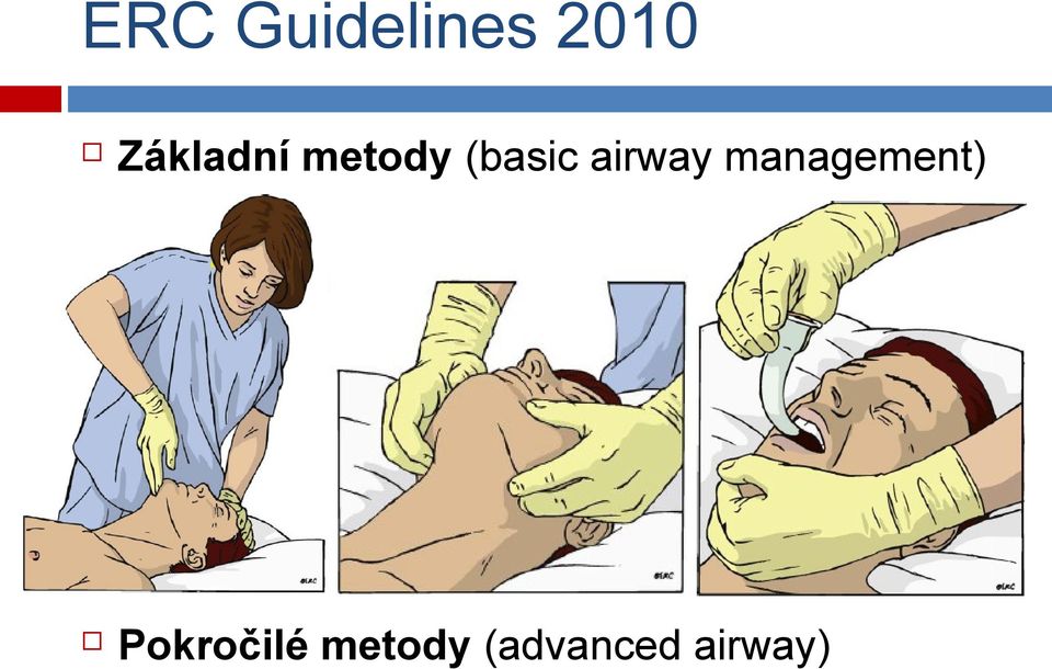 airway management)