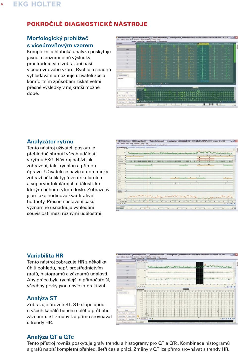Analyzátor rytmu Tento nástroj uživateli poskytuje přehledné shrnutí všech událostí v rytmu EKG. Nástroj nabízí jak zobrazení, tak i rychlou a přímou úpravu.