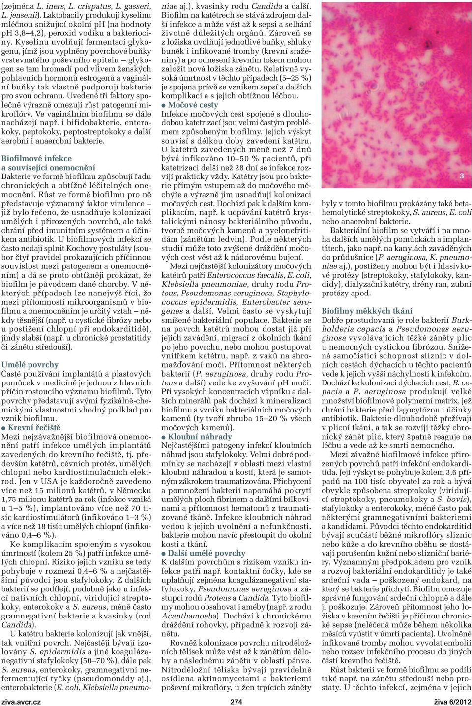 tak vlastně podporují bakterie pro svou ochranu. Uvedené tři faktory společně výrazně omezují růst patogenní mi - kroflóry. Ve vaginálním biofilmu se dále nacházejí např.
