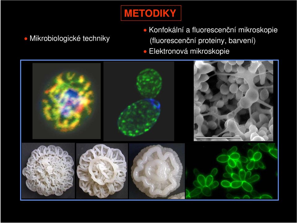 fluorescenční mikroskopie