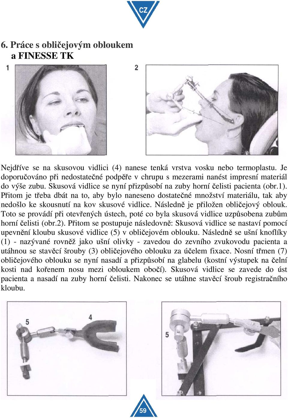 Přitom je třeba dbát na to, aby bylo naneseno dostatečné množství materiálu, tak aby nedošlo ke skousnutí na kov skusové vidlice. Následně je přiložen obličejový oblouk.