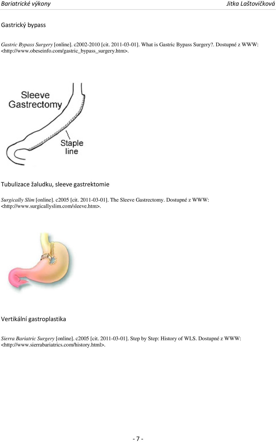 Tubulizace žaludku, sleeve gastrektomie Surgically Slim [online]. c2005 [cit. 2011-03-01]. The Sleeve Gastrectomy.