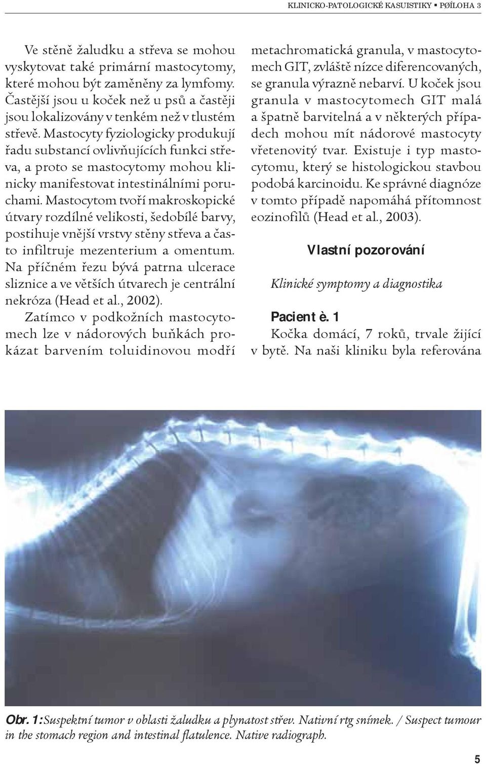 Mastocytom tvoøí makroskopické útvary rozdílné velikosti, šedobílé barvy, postihuje vnìjší vrstvy stìny støeva a èasto infiltruje mezenterium a omentum.