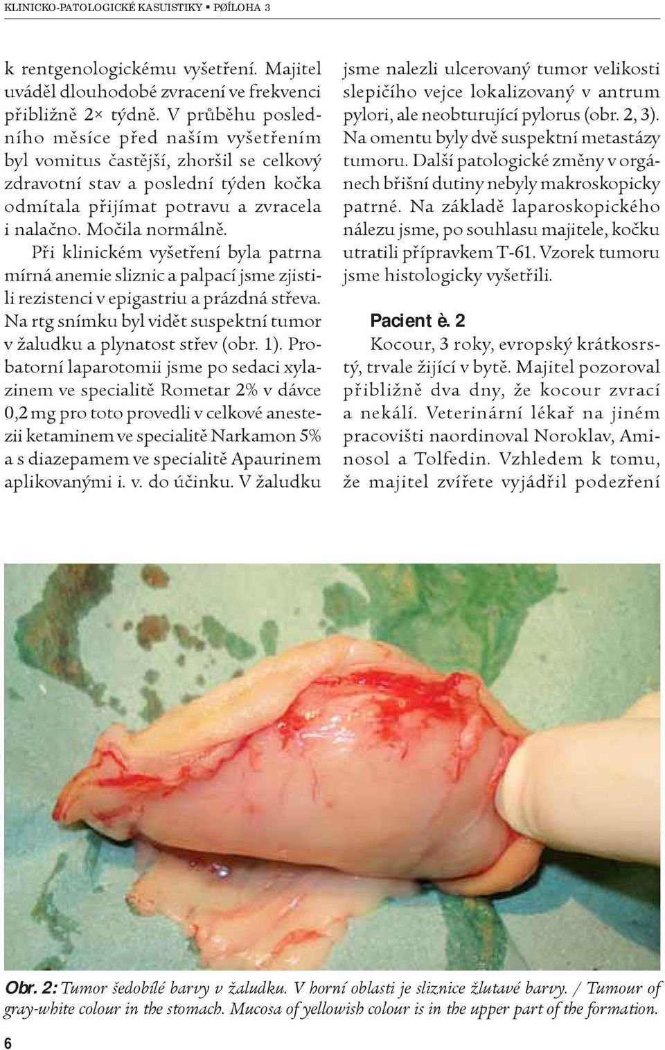 Pøi klinickém vyšetøení byla patrna mírná anemie sliznic a palpací jsme zjistili rezistenci v epigastriu a prázdná støeva. Na rtg snímku byl vidìt suspektní tumor v žaludku a plynatost støev (obr. 1).