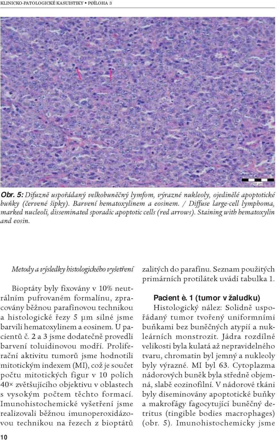 Metody a výsledky histologického vyšetøení Bioptáty byly fixovány v 10% neutrálním pufrovaném formalínu, zpracovány bìžnou parafínovou technikou a histologické øezy 5 μm silné jsme barvili