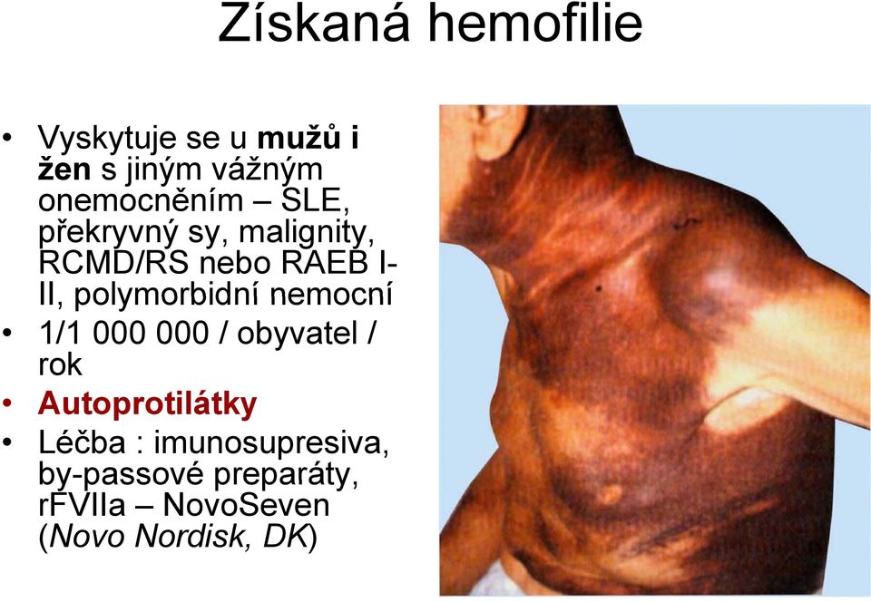 polymorbidní nemocní 1/1 000 000 / obyvatel / rok Autoprotilátky