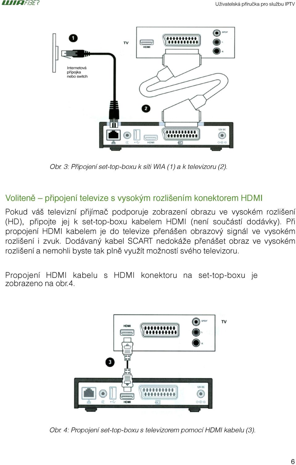 set-top-boxu kabelem HDMI (není součástí dodávky). Při propojení HDMI kabelem je do televize přenášen obrazový signál ve vysokém rozlišení i zvuk.