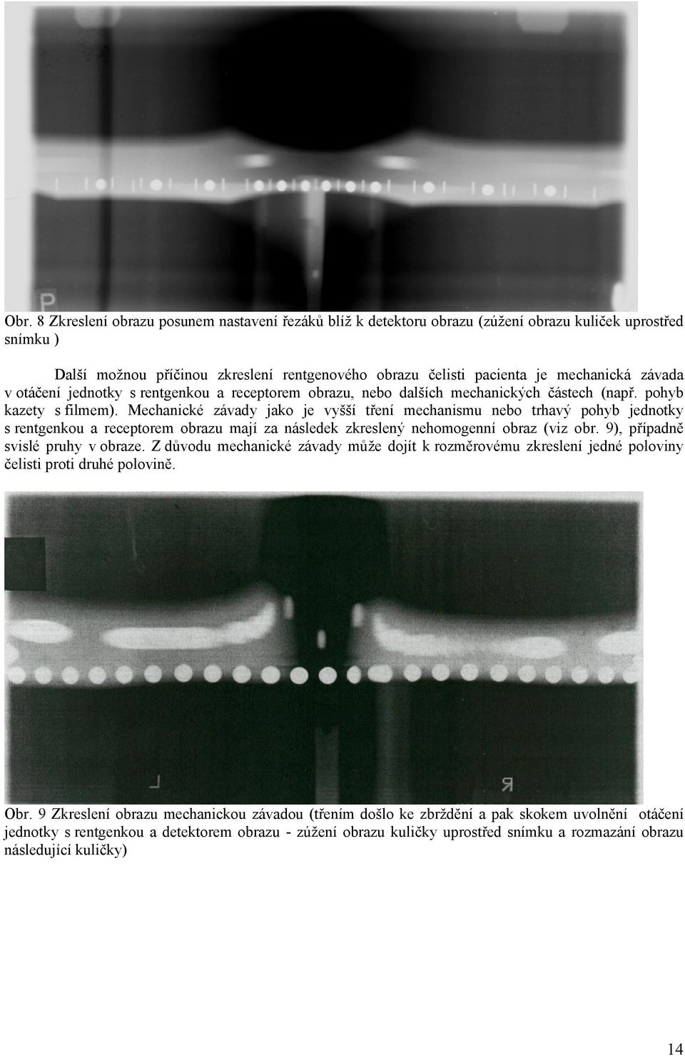 Mechanické závady jako je vyšší tření mechanismu nebo trhavý pohyb jednotky s rentgenkou a receptorem obrazu mají za následek zkreslený nehomogenní obraz (viz obr. 9), případně svislé pruhy v obraze.