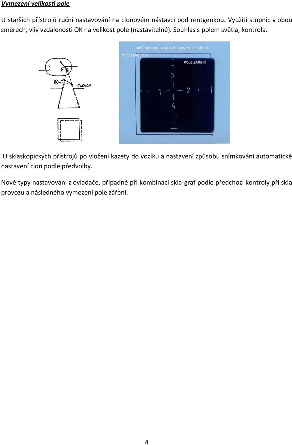 U skiaskopických přístrojů po vložení kazety do vozíku a nastavení způsobu snímkování automatické nastavení clon podle
