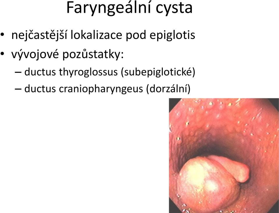 pozůstatky: ductus thyroglossus