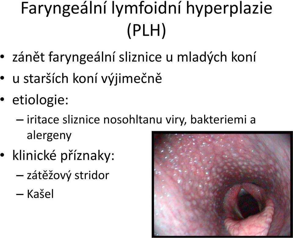 výjimečně etiologie: iritace sliznice nosohltanu