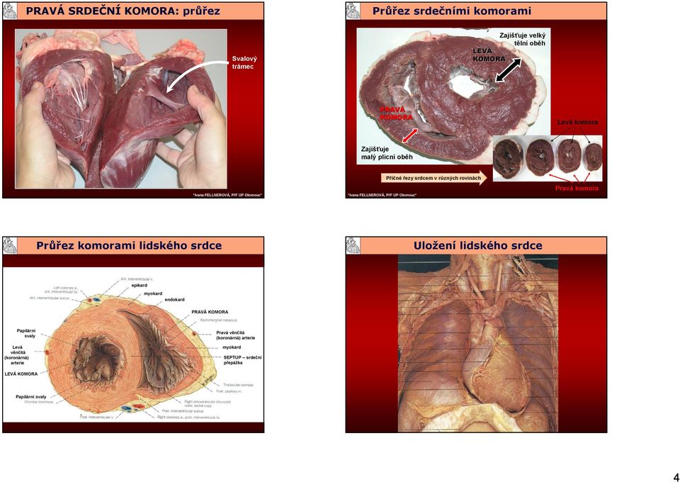 komorami lidského srdce Průřez komorami lidského srdce Uložení lidského srdce Uložení lidského srdce epikard myokard endokard PRAVÁ KOMORA