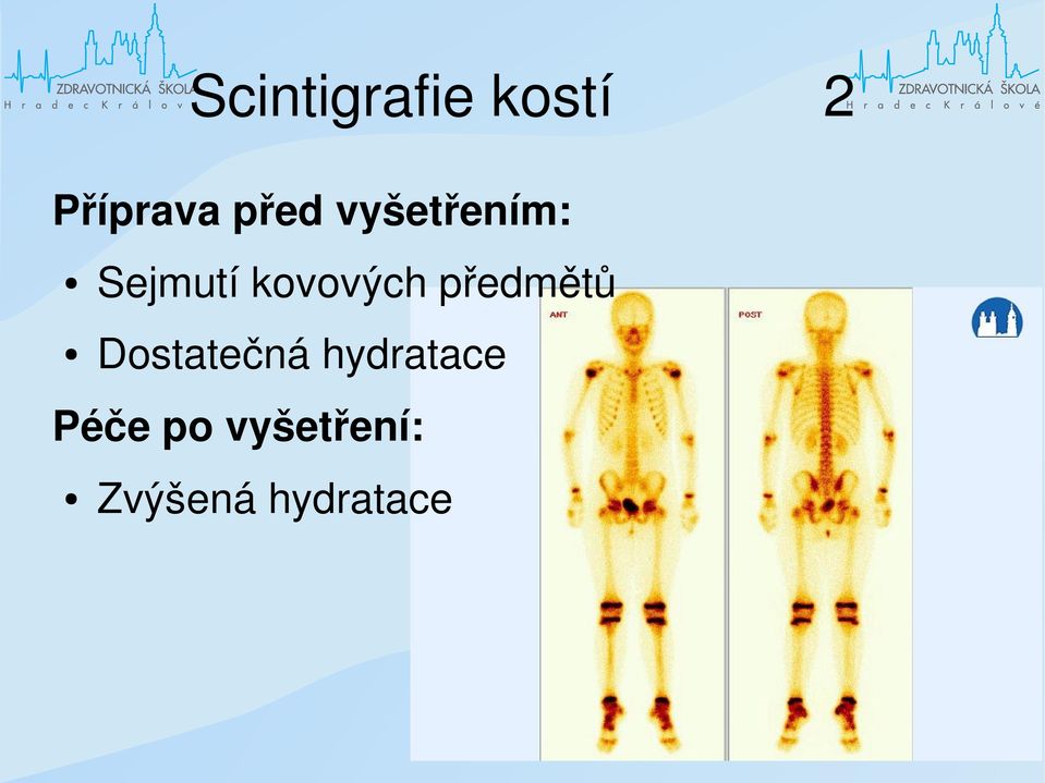 kovových předmětů Dostatečná