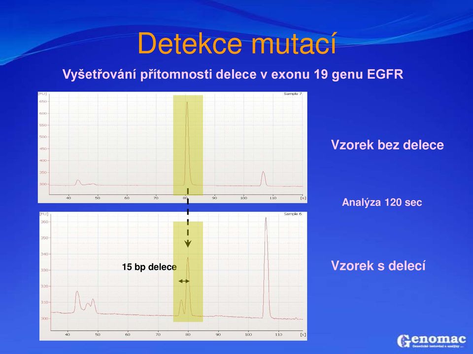 genu EGFR Vzorek bez delece