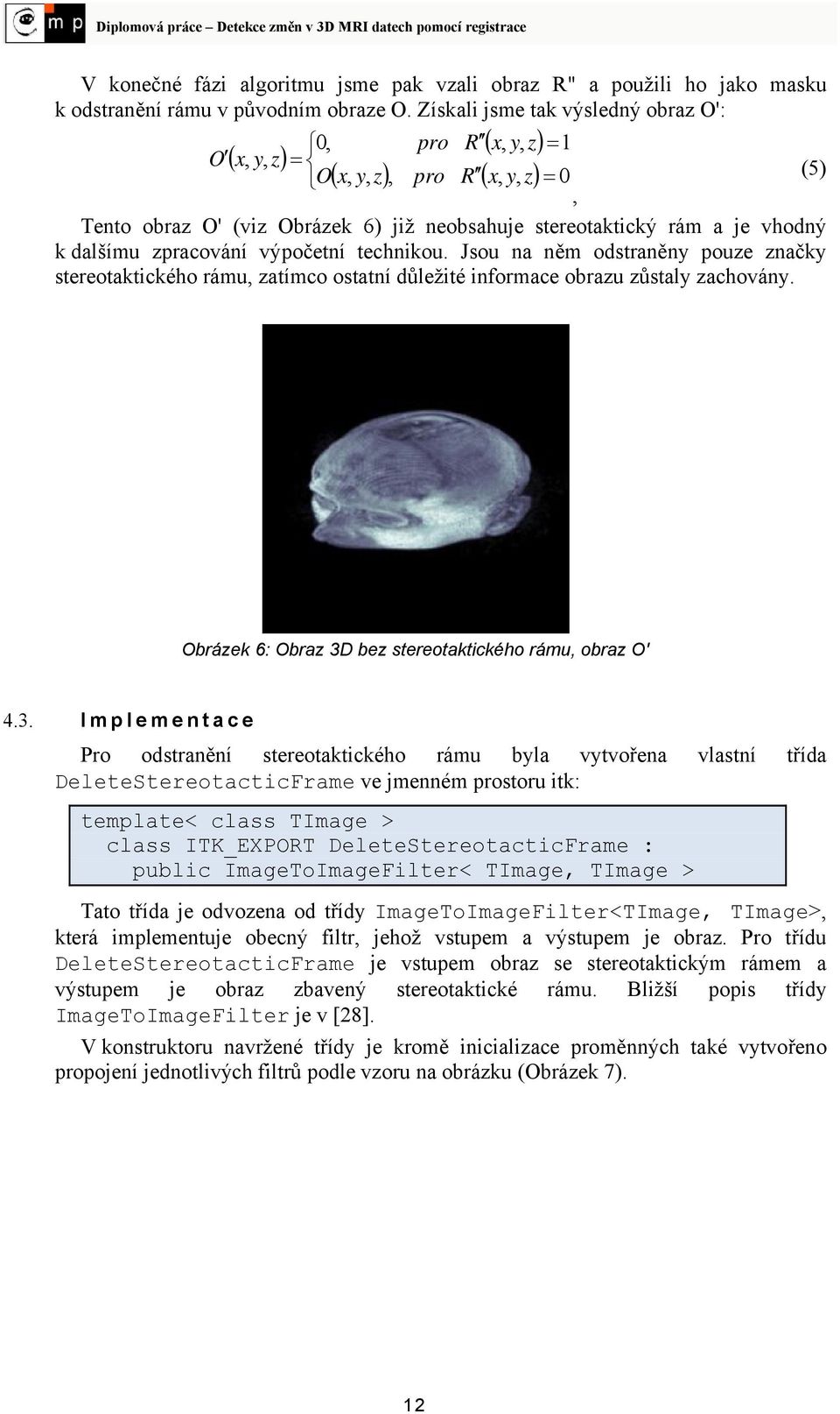 zpracování výpočetní technikou. Jsou na něm odstraněny pouze značky stereotaktického rámu, zatímco ostatní důležité informace obrazu zůstaly zachovány.