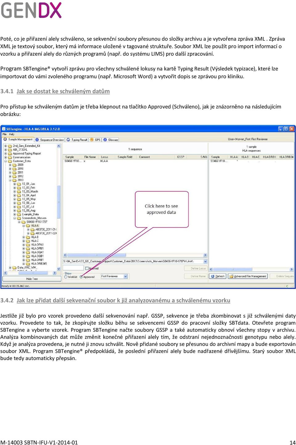 Program SBTengine vytvoří zprávu pro všechny schválené lokusy na kartě Typing Result (Výsledek typizace), které lze importovat do vámi zvoleného programu (např.