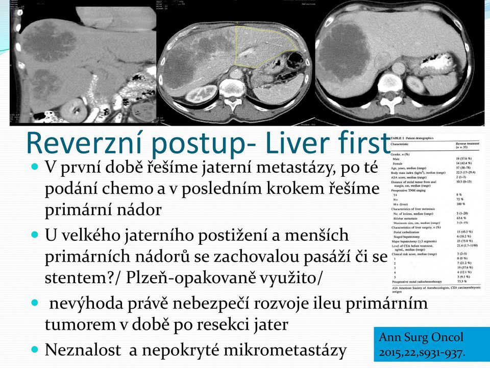 nádor U velkého jaterního postižení a menších primárních nádorů se zachovalou pasáží či se stentem?