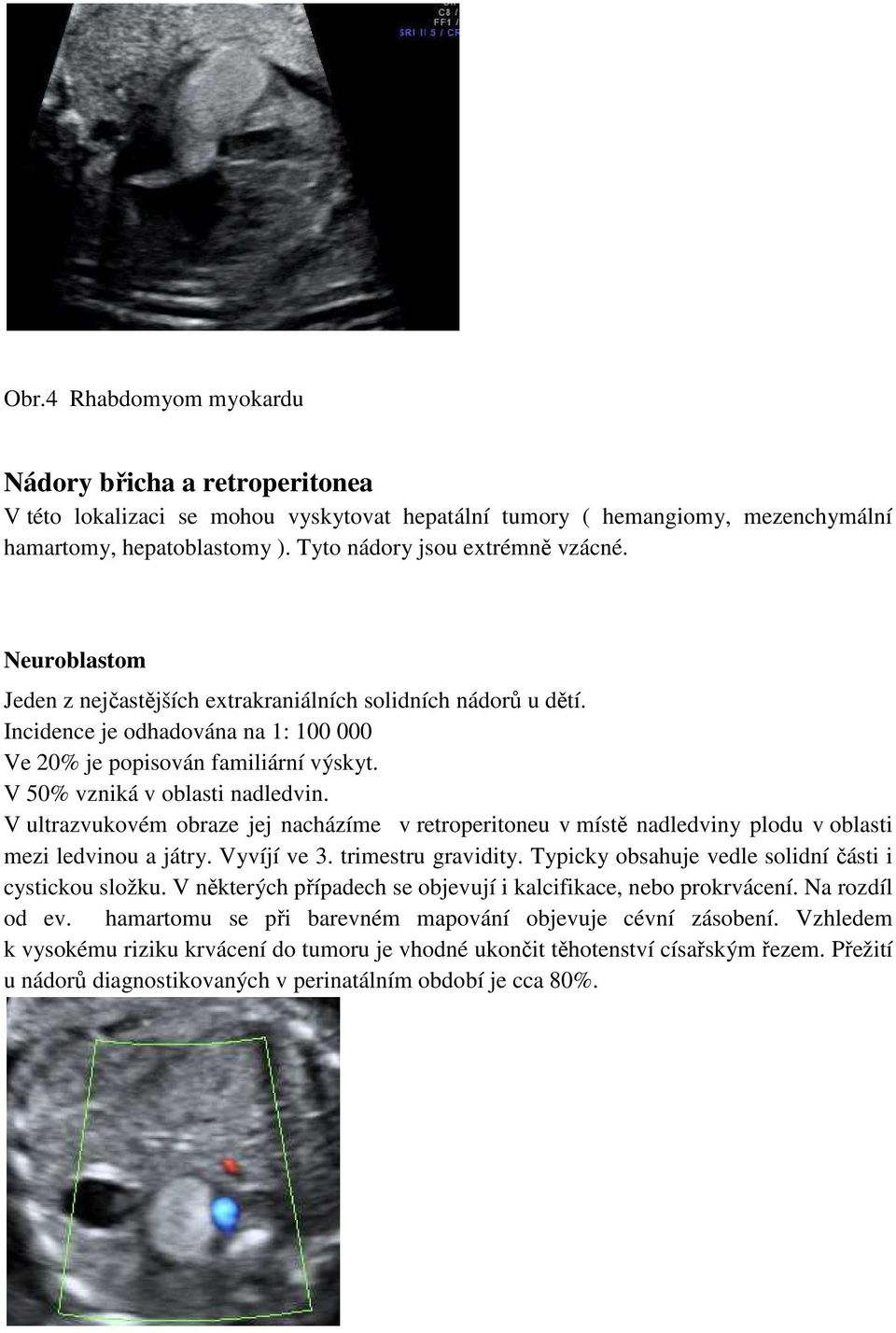 V 50% vzniká v oblasti nadledvin. V ultrazvukovém obraze jej nacházíme v retroperitoneu v místě nadledviny plodu v oblasti mezi ledvinou a játry. Vyvíjí ve 3. trimestru gravidity.