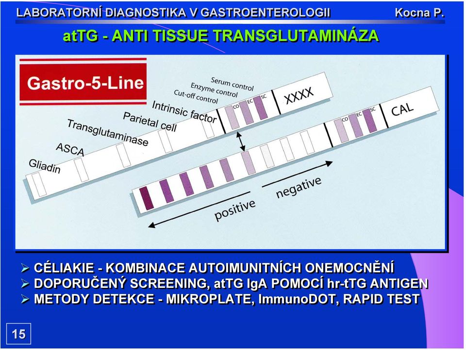 DOPORUČENÝ SCREENING, attg IgA POMOCÍ hr-ttg