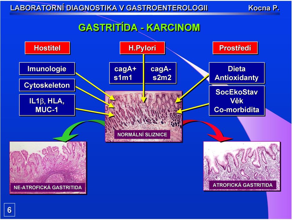 MUC-1 caga+ + caga- s1m1 s2m2 Dieta Antioxidanty