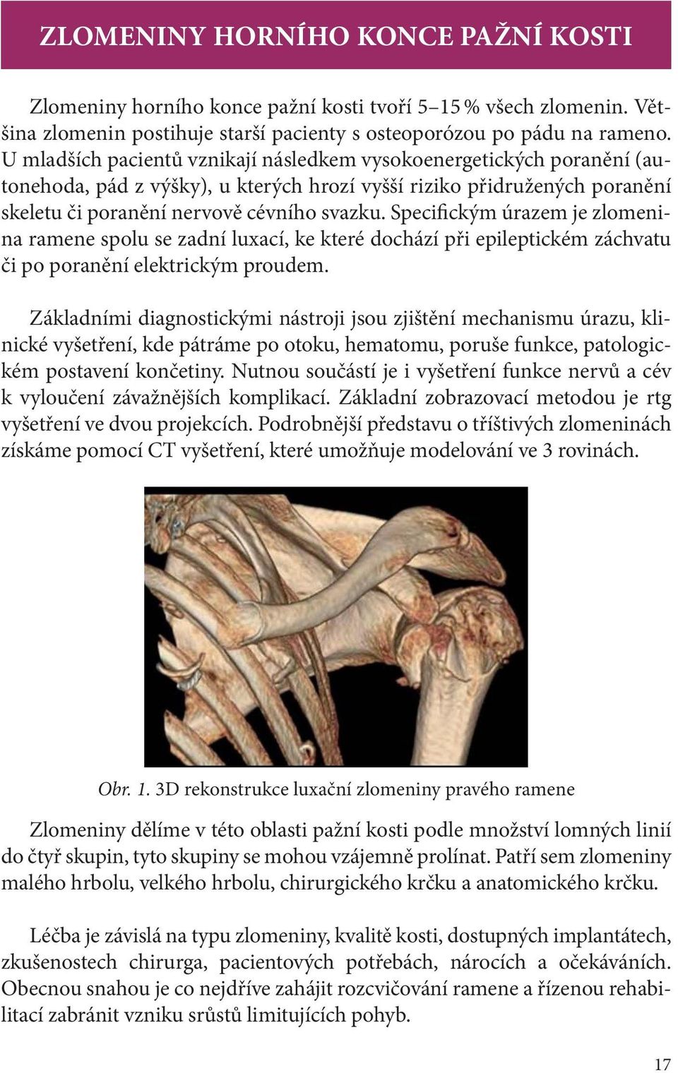 Specifickým úrazem je zlomenina ramene spolu se zadní luxací, ke které dochází při epileptickém záchvatu či po poranění elektrickým proudem.