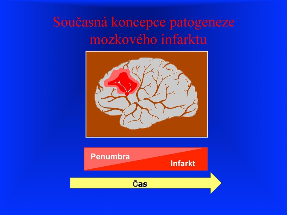 mozkového