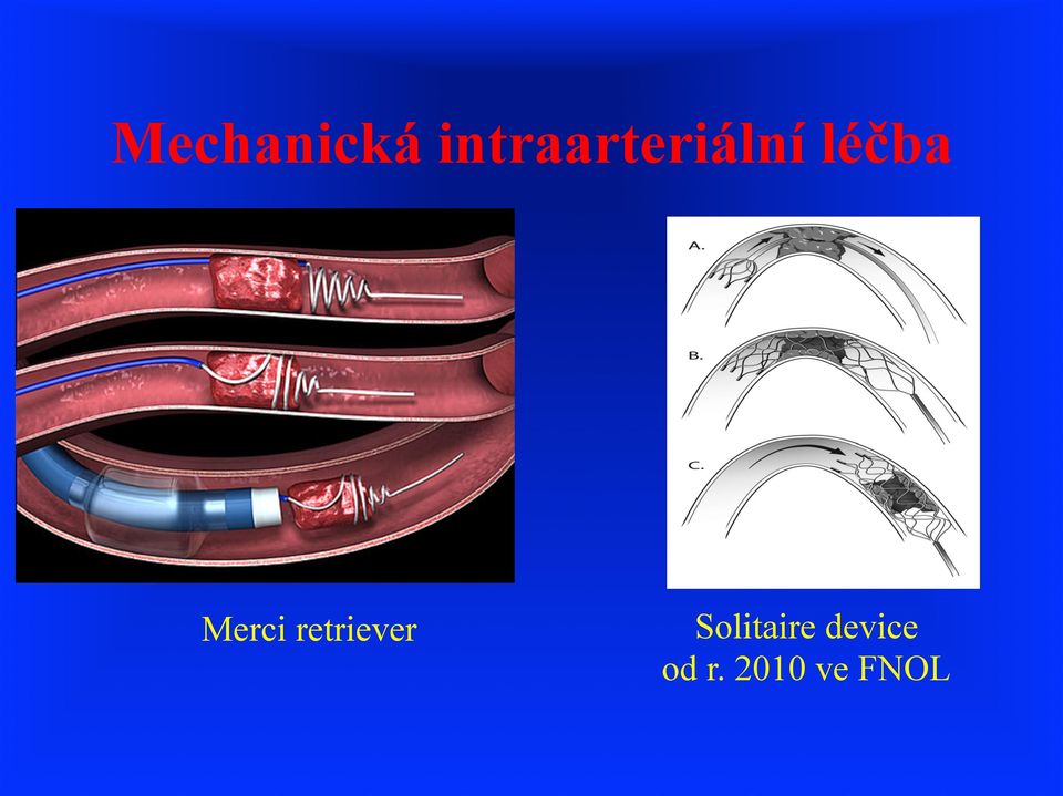 léčba Merci