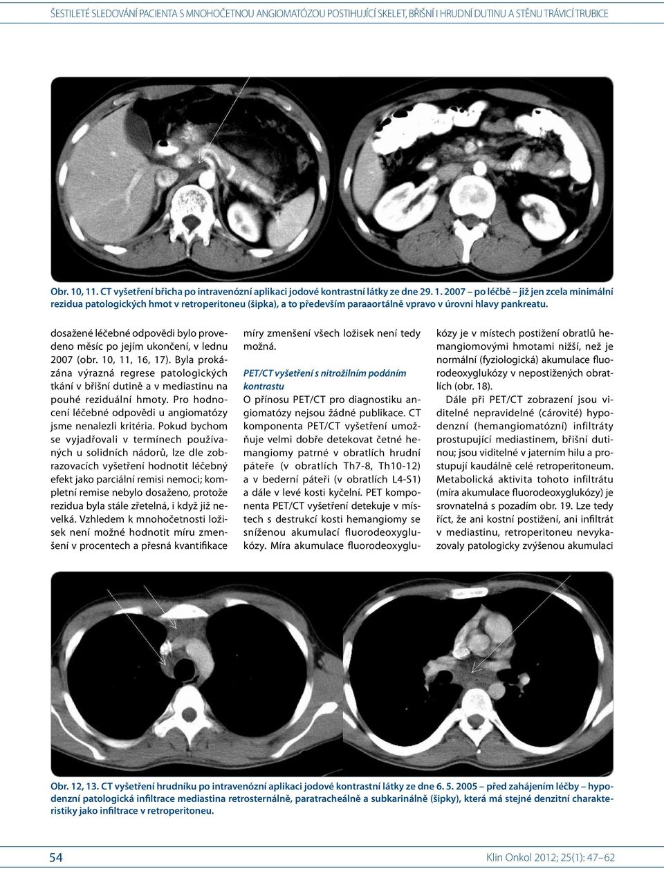 CT komponenta PET/CT vyšetření umožňuje velmi dobře detekovat četné hemangiomy patrné v obratlích hrudní páteře (v obratlích Th7-8, Th10-12) a v bederní páteři (v obratlích L4-S1) a dále v levé kosti