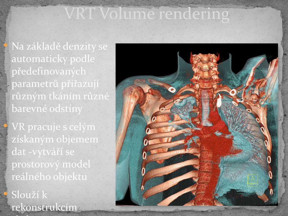 barevné odstíny VR pracuje s celým získaným objemem dat