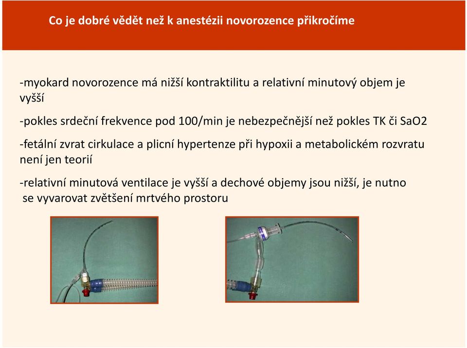 SaO2 -fetální zvrat cirkulace a plicní hypertenze při hypoxii a metabolickém rozvratu není jen teorií