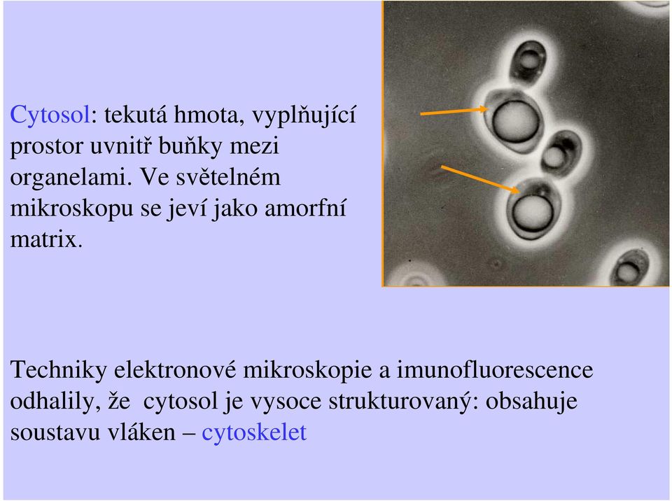 Techniky elektronové mikroskopie a imunofluorescence odhalily,